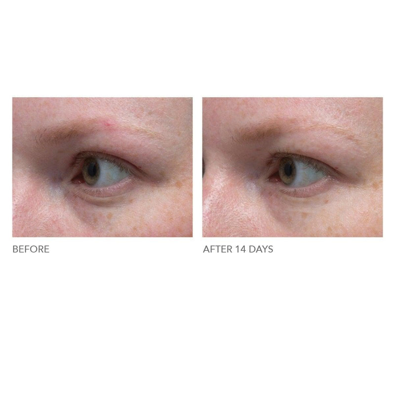 Hyaluronic Marine Dew It right eye gel - Ambiance Skin Care Salon & Day Spa