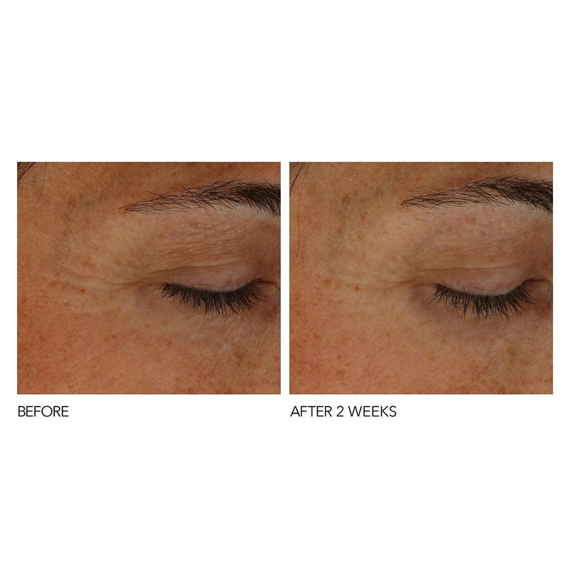 B³Adaptive SuperFoods Stress SOS Eye Cream - Ambiance Skin Care Salon & Day Spa